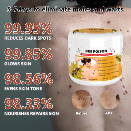 šLOVILDS⢠Bee Poison Mole and Wart Treatment Cream