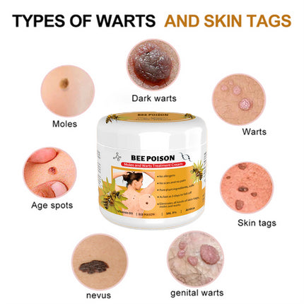 šLOVILDS⢠Bee Poison Mole and Wart Treatment Cream