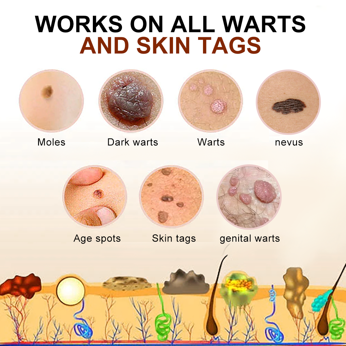 šLOVILDS⢠Bee Poison Mole and Wart Treatment Cream