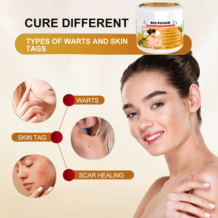 šLOVILDS⢠Bee Poison Mole and Wart Treatment Cream