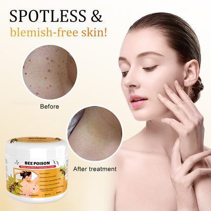 šLOVILDS⢠Bee Poison Mole and Wart Treatment Cream