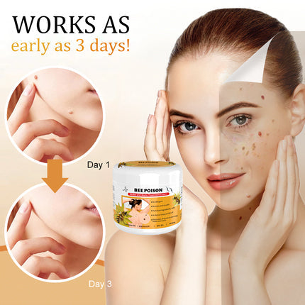 šLOVILDS⢠Bee Poison Mole and Wart Treatment Cream