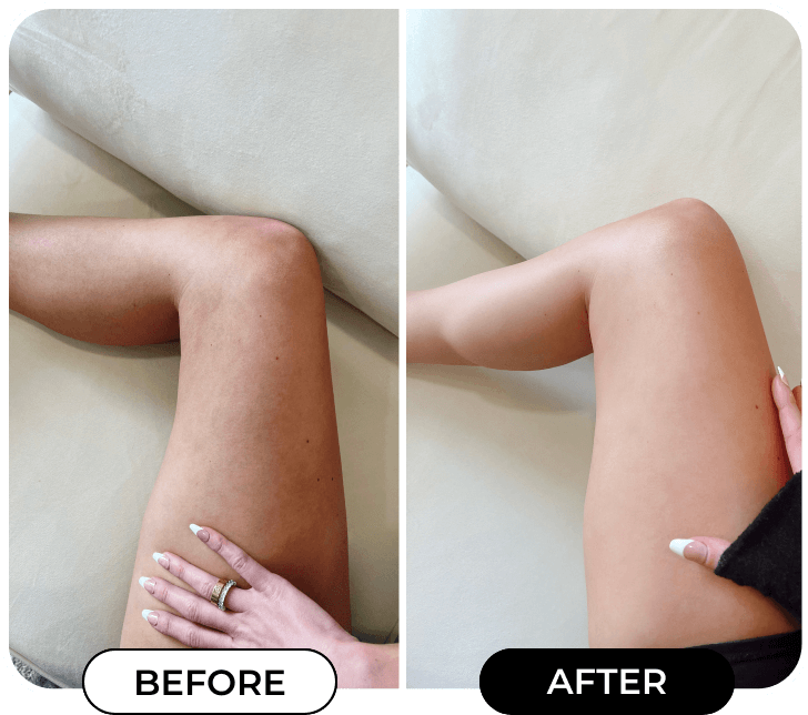MINIYOU® B-FLAT Advanced Belly Firming Cream