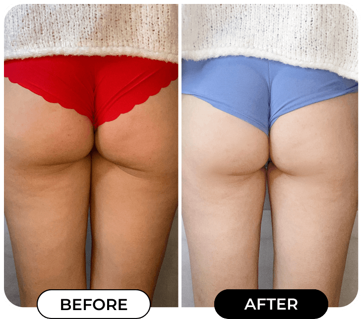 MINIYOU® B-FLAT Advanced Belly Firming Cream