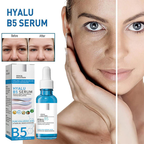 Last Day Promotion 70% OFF - š„ Hyalu B5 Pure Anti-Aging Face Serum