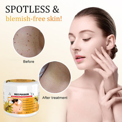 🐝LOVILDS™  Bee Poison Mole and Wart Treatment Cream