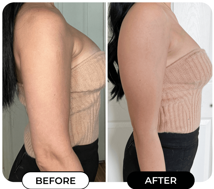 MINIYOU® B-FLAT Advanced  Belly Firming Cream