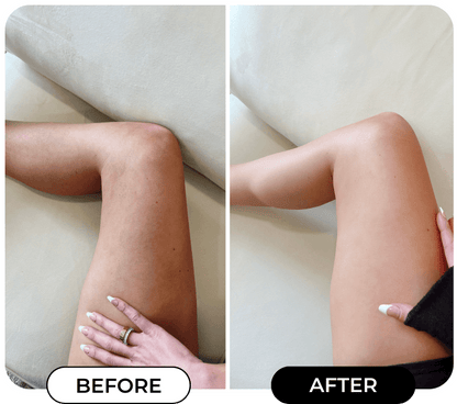MINIYOU® B-FLAT Advanced  Belly Firming Cream