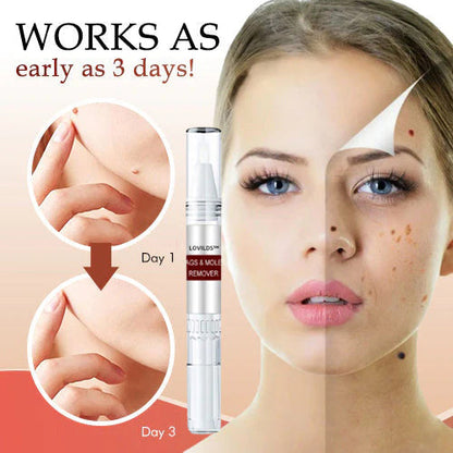 🎁Official Factory Direct Sales🎁LOVILDS™ Tags & Moles Remover